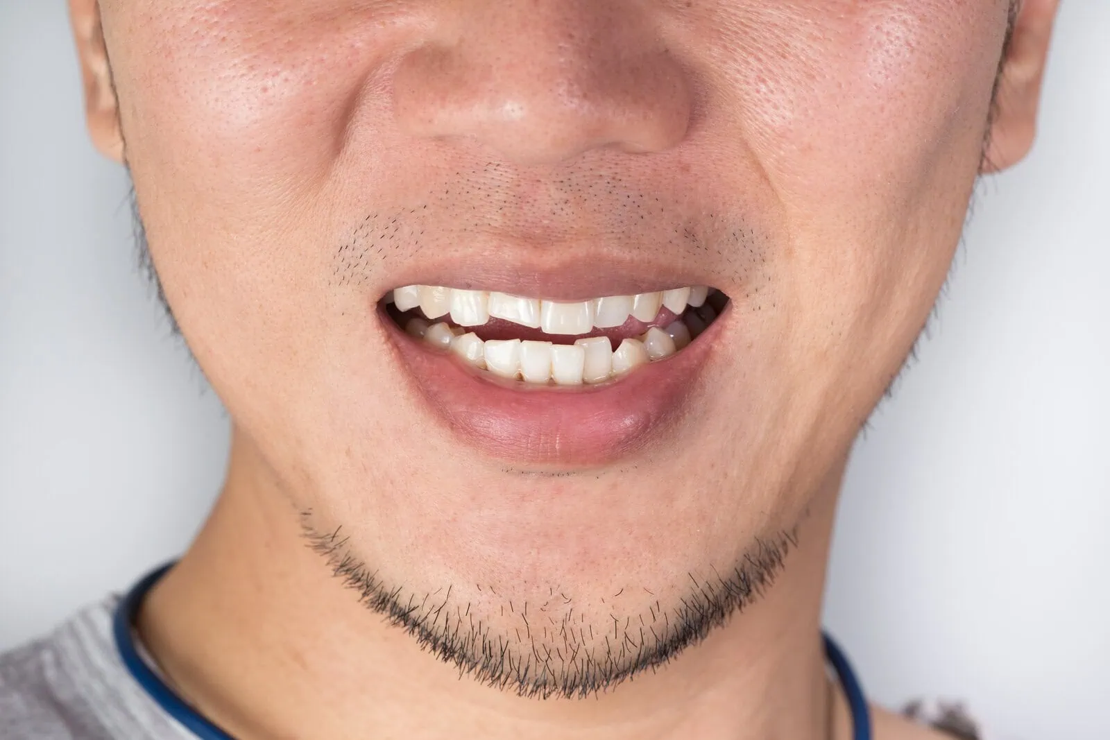 Sudden dental pain or injury treated quickly